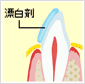 ホワイトニング剤