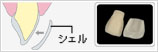 ラミネートベニア