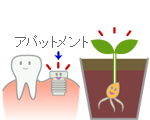 アパットメント